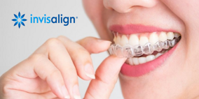ortodonzia-invisibile-invisalign
