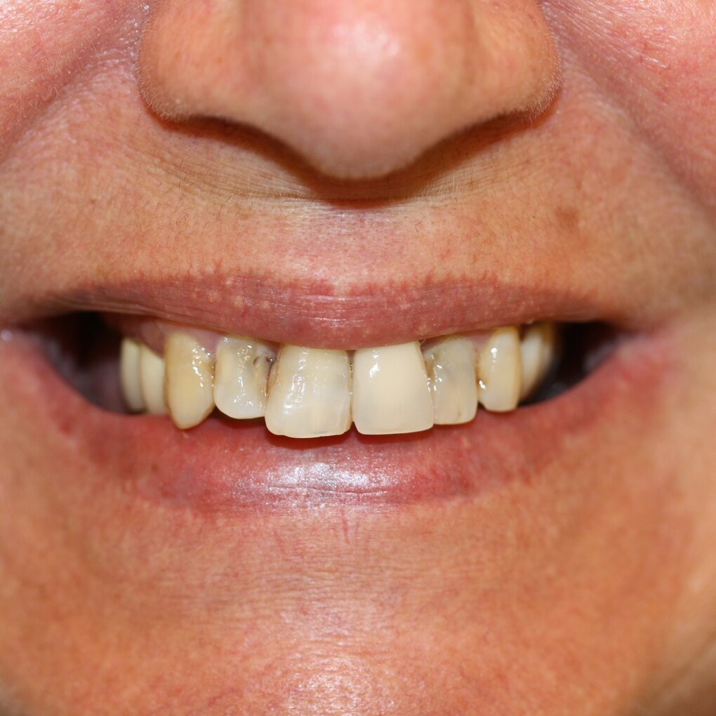 Dentista Roma Prati dott. Antonio Romano Meii Caldora