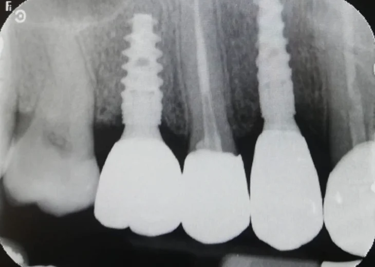 dentista roma centro storico