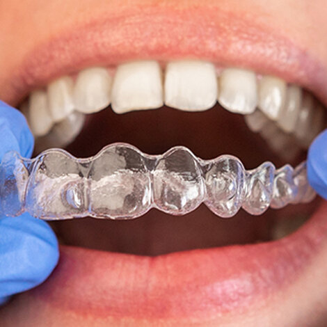 studio dentistico roma prati apparecchi denti 