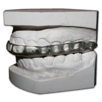 bite-dentale-1.jpeg