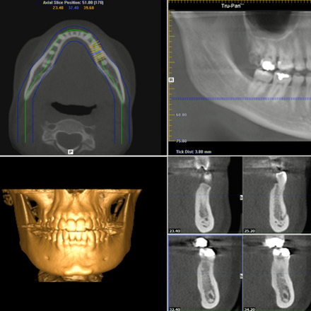 studio dentistico prati delle vittorie roma dott. romano mei caldora
