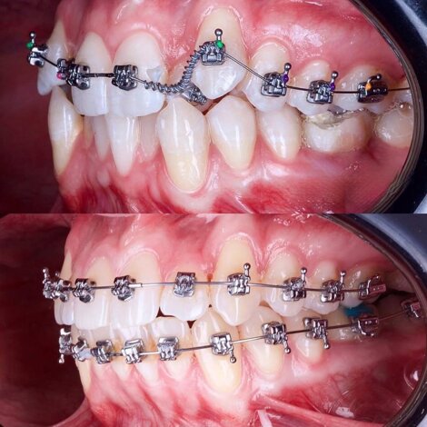 studio dentistico romano mei caldora centro storico apparecchio denti
