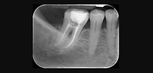 endodonzia- antonio romano mei caldora.jpeg endodonzia- antonio romano mei caldora.jpeg