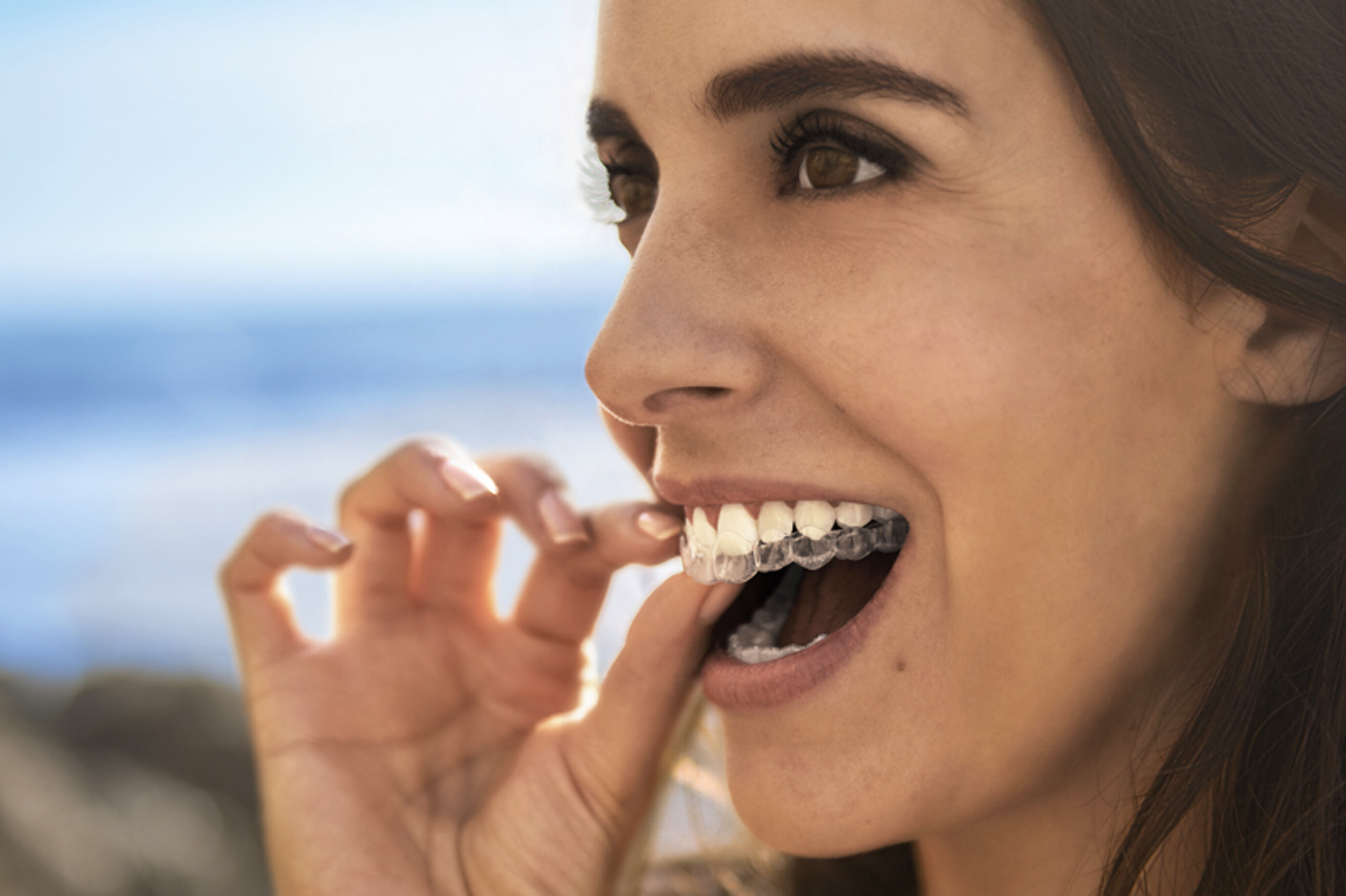 invisalign-indossato.jpeg invisalign-indossato.jpeg