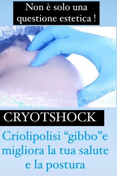 gibbo cryo.jpeg gibbo cryo.jpeg
