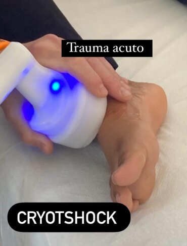trauma acuto cryo.jpeg trauma acuto cryo.jpeg