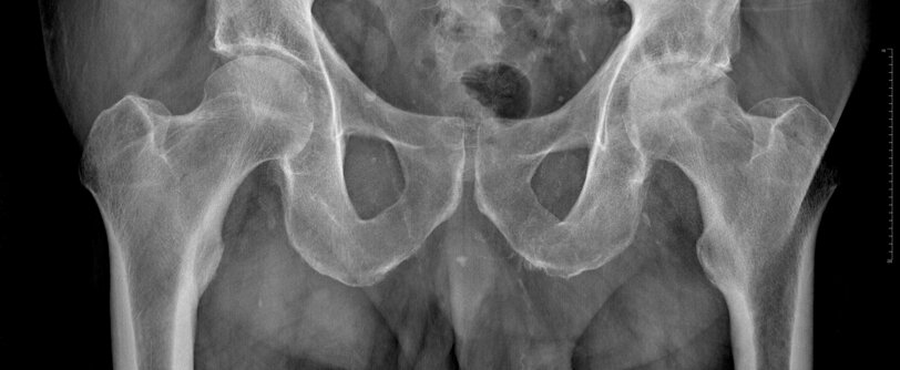 10396466dc1e5f04acce22a46181fe17b8959b45.jpeg 10396466dc1e5f04acce22a46181fe17b8959b45.jpeg