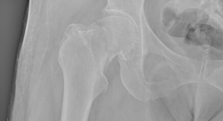 49e6497d63c2772855bf05f35980b0a8665c6e5e.jpeg 49e6497d63c2772855bf05f35980b0a8665c6e5e.jpeg