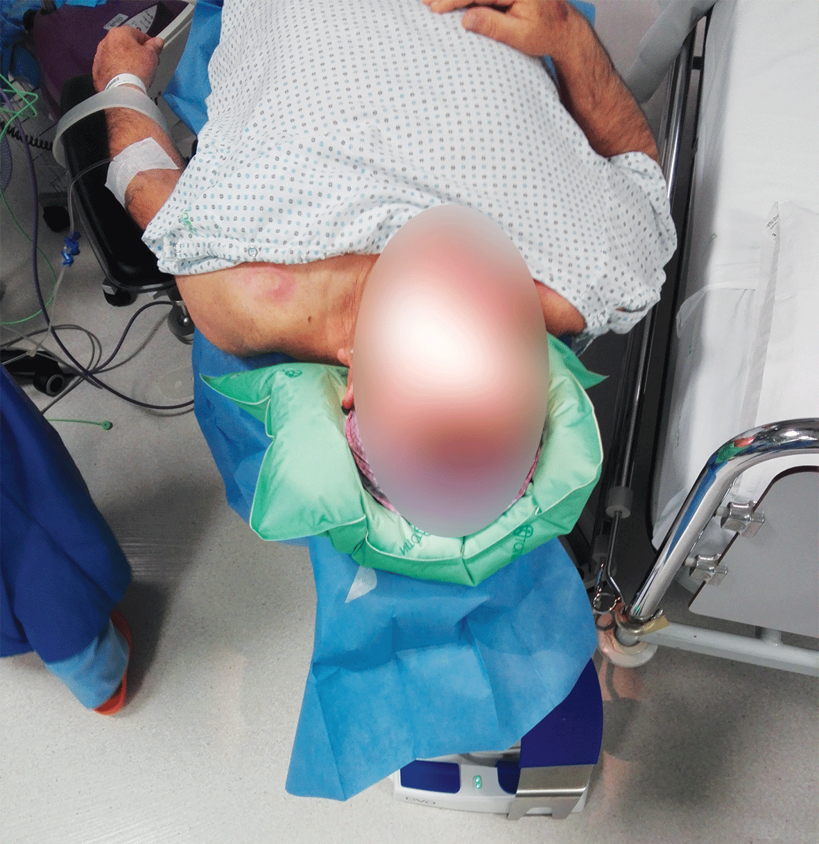 eyJlbiI6IlJpZ2lkIGFuZCBtZW1vcnkgZm9hbSBwb3NpdGlvbmluZyBhbmQgaW1tb2JpbGl6YXRpb24gQ3VzaGlvbi4gRHVyYWJsZSBTdXBwb3J0IFVsdGltYXRlIENvbWZvcnQgT3BodGFsbW9sb2d5In0=