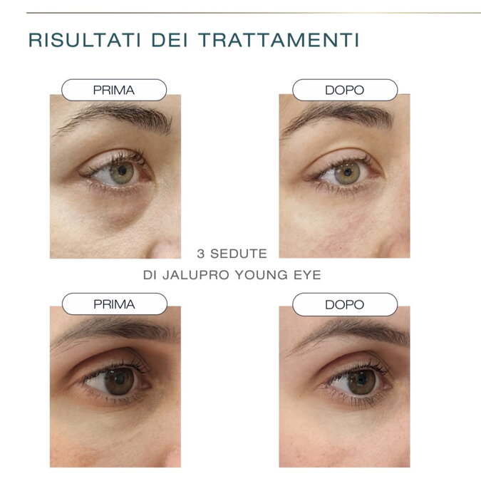Biorivitalizzazione