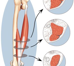 Axial cross-sections depicting the myotendinous junction anatomy