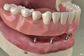 screenshot 2025-04-10 alle 15.53.43