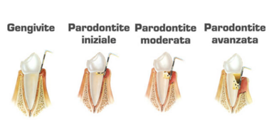 parodontologia parodontologia