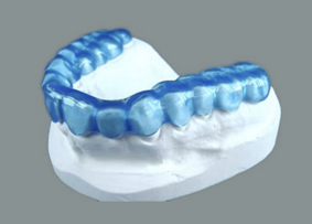 apparecchi per bruxismo