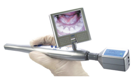 tpc telecamera intraorale