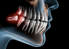 estrazioni (semplici e indaginose)