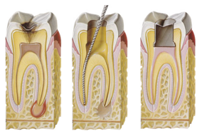 endodonzia endodonzia