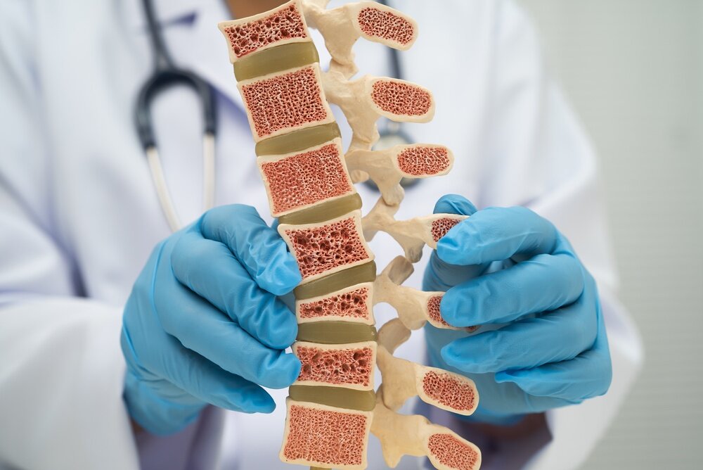 Osteoporosi silenziosa: 7 segnali da non sottovalutare