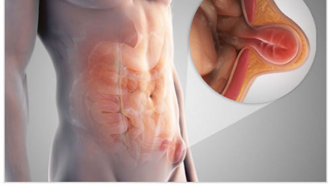 31287aab5aa67229489c5aa9a09fc83b5b4417eb