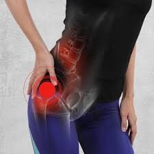 BORSITE TROCANTERICA