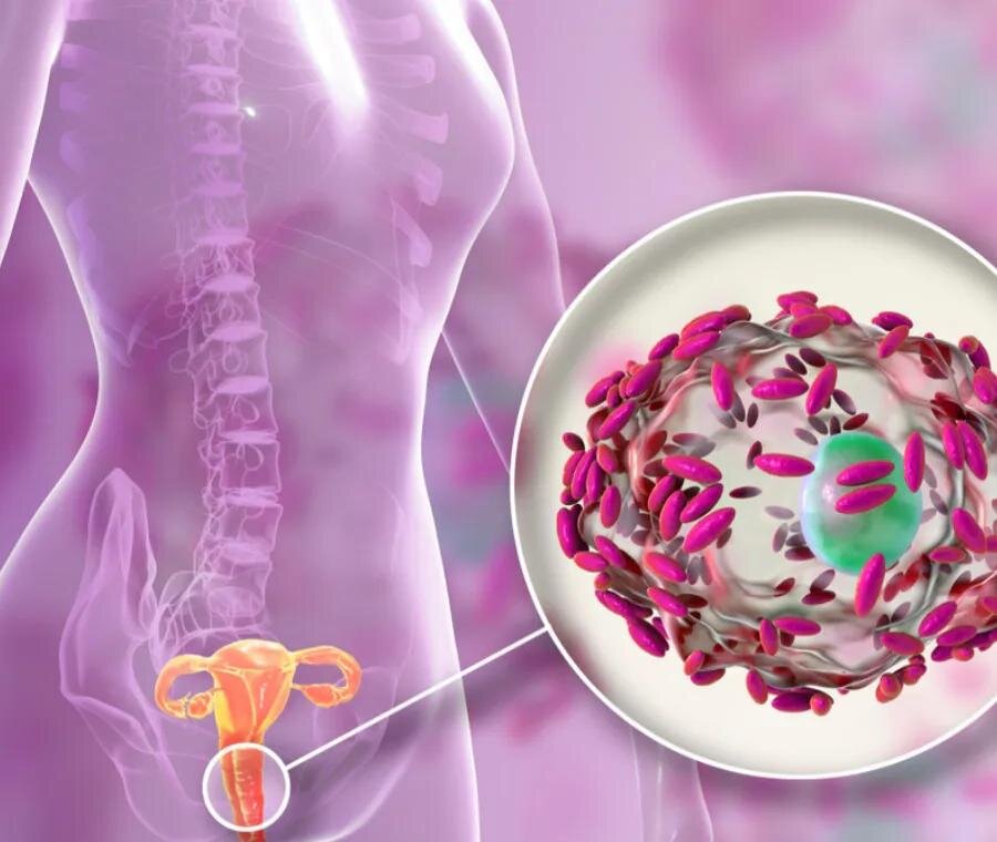 Nutrizione e Salute del Microbioma Vaginale: L'Impatto della Dieta sulla Composizione del Microbioma Vaginale e sulla Prevenzione delle Infezioni Nutrizione e Salute del Microbioma Vaginale: L'Impatto della Dieta sulla Composizione del Microbioma Vaginale e sulla Prevenzione delle Infezioni