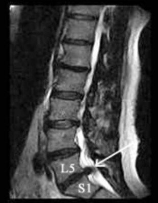 Ozonoterapia ecoguidata Milano e Parabiago comoda con la Svizzera colonna vertebrale Ozonoterapia ecoguidata Milano e Parabiago comoda con la Svizzera colonna vertebrale