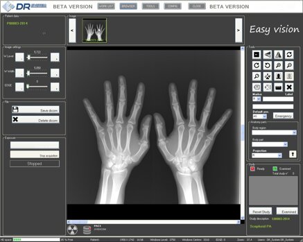 60e22062c357f9552b04726dc120cd8637beecb7