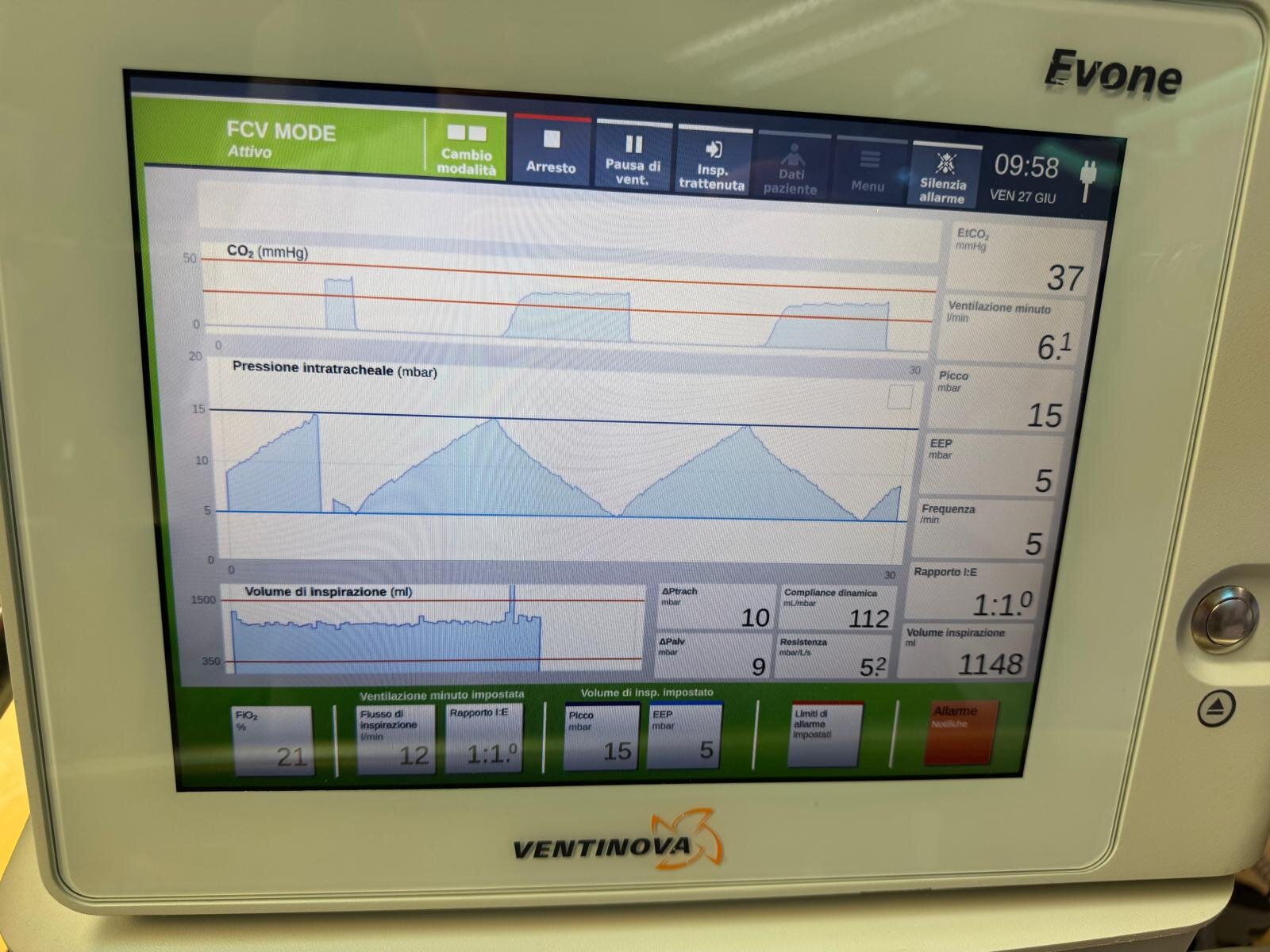 Flow-controlled Ventilation