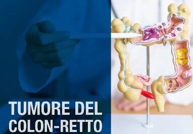 Prevenzione e trattamento tumore al colon