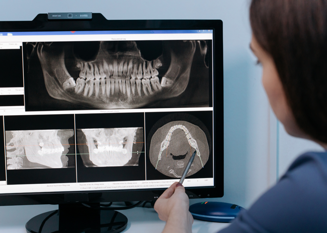 diagnosi digitale denti
