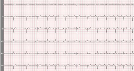 Elettrocardiogramma Centro Ecografico Veterinario Echo Vet
