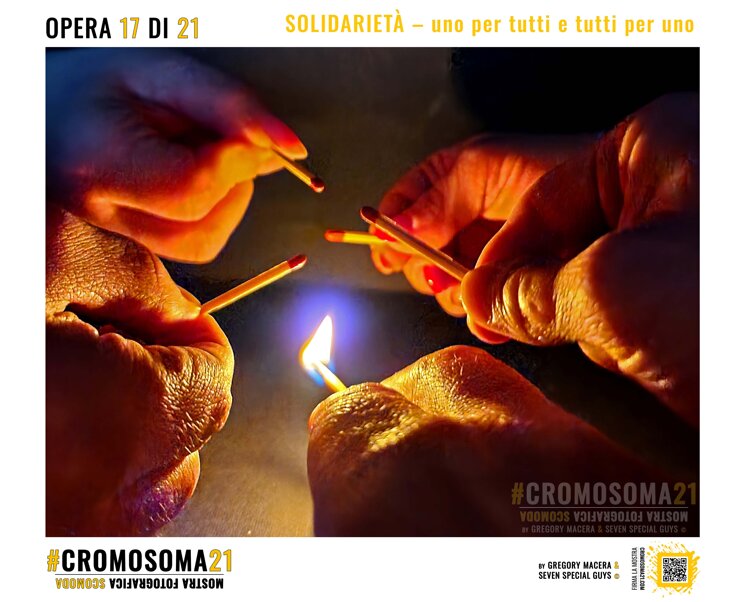 sindrome di down, cromosoma 21, cromosoma21, gregory macera, macera gregory