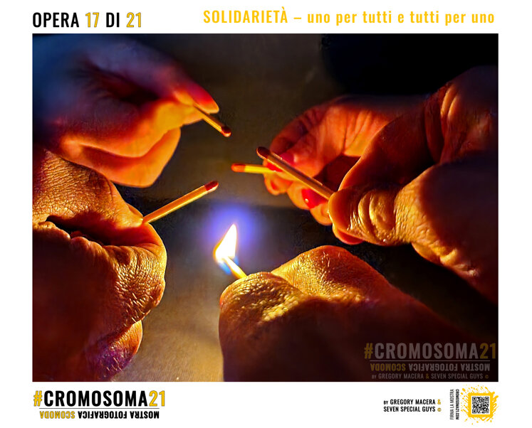 sindrome di down, cromosoma 21, cromosoma21, gregory macera