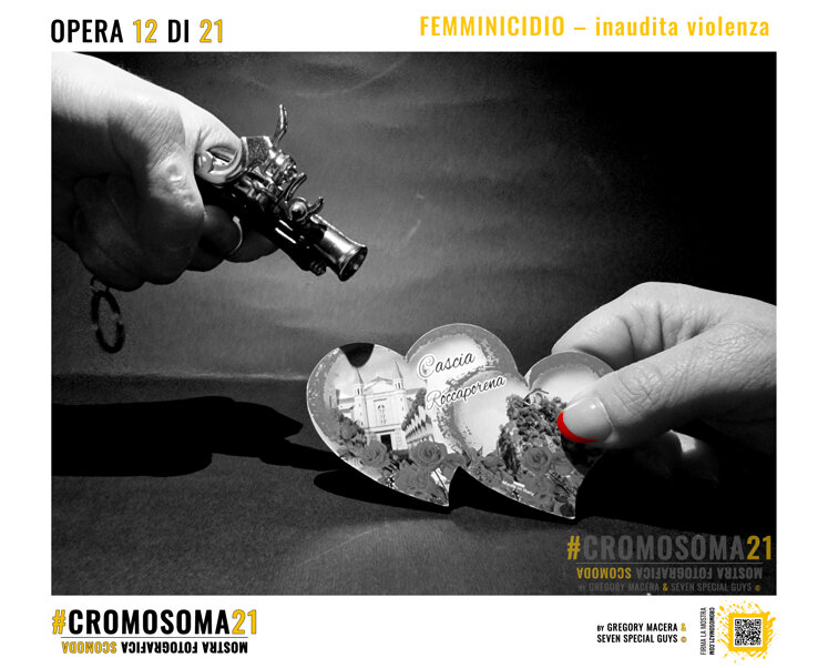 sindrome di down, cromosoma 21, cromosoma21, gregory macera