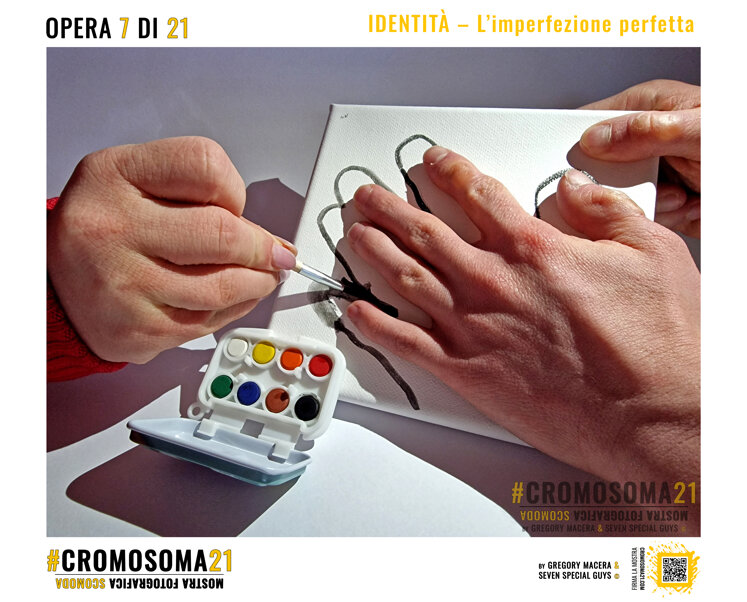 sindrome di down, cromosoma 21, cromosoma21, gregory macera