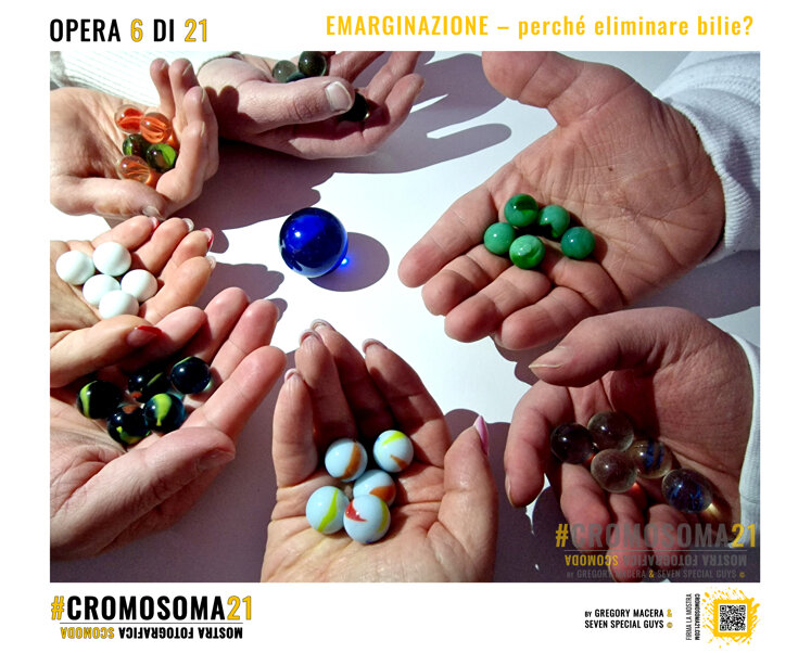 sindrome di down, cromosoma 21, cromosoma21, gregory macera