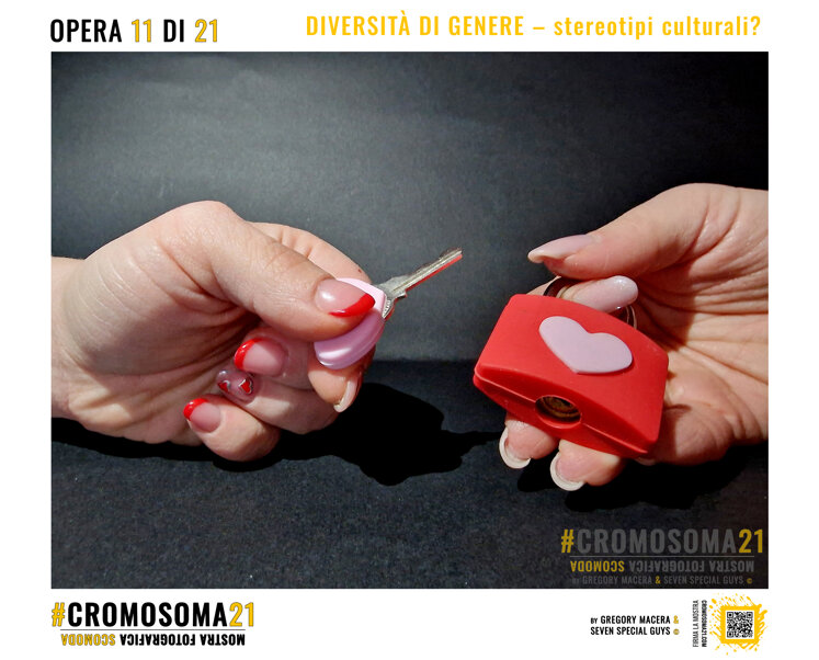 sindrome di down, cromosoma 21, cromosoma21, gregory macera
