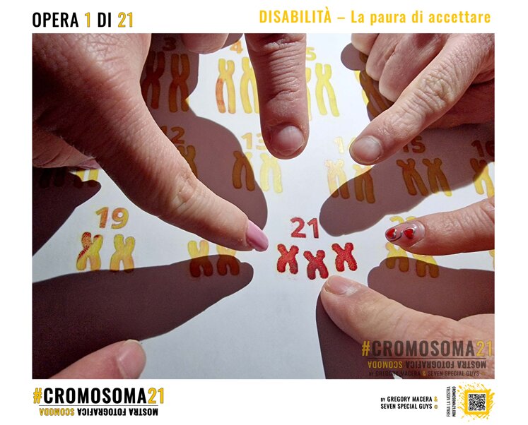 sindrome di down, cromosoma 21, cromosoma21, gregory macera, macera gregory