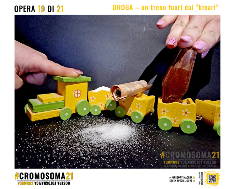 sindrome di down, cromosoma 21, cromosoma21, gregory macera
