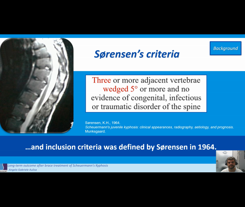 Webinar sosort sulla ipercifosi