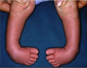 3dda7016f01eae836594bd95677e1fb77e8d9474