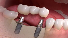 fd25f374625f1aba66c4092bcd3eb03f61574a7f