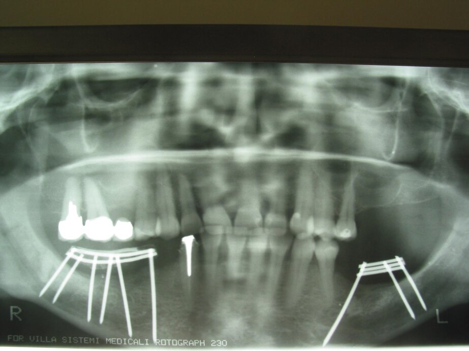 Controllo radiologico post-operatorio