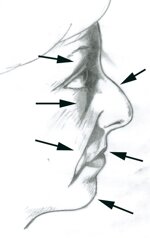 cefalometria