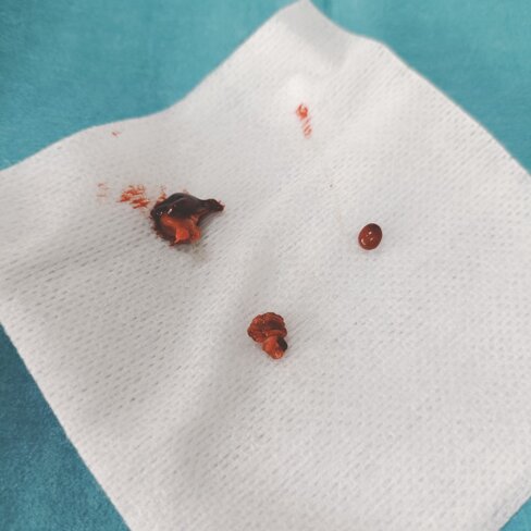 whatsapp image 2026-03-28 at 10.04.11.jpeg whatsapp image 2026-03-28 at 10.04.11.jpeg