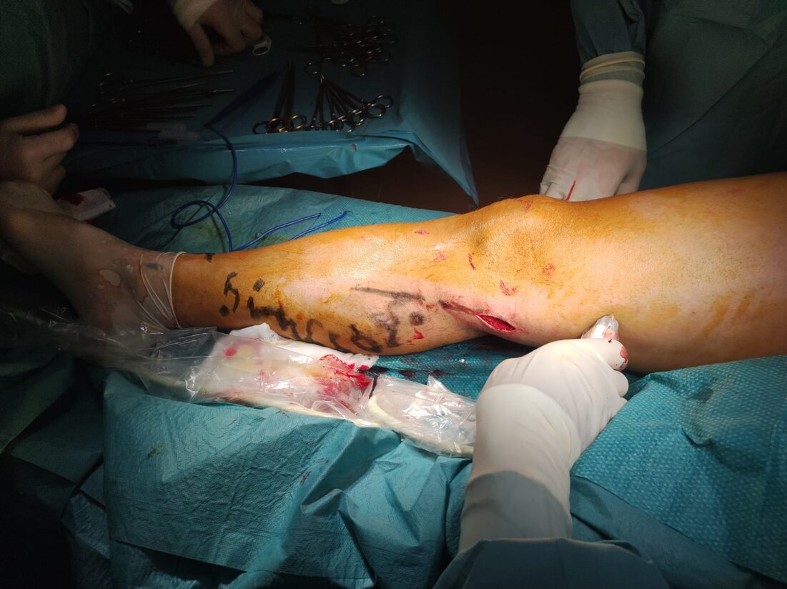 whatsapp image 2025-11-21 at 17.32.45.jpeg