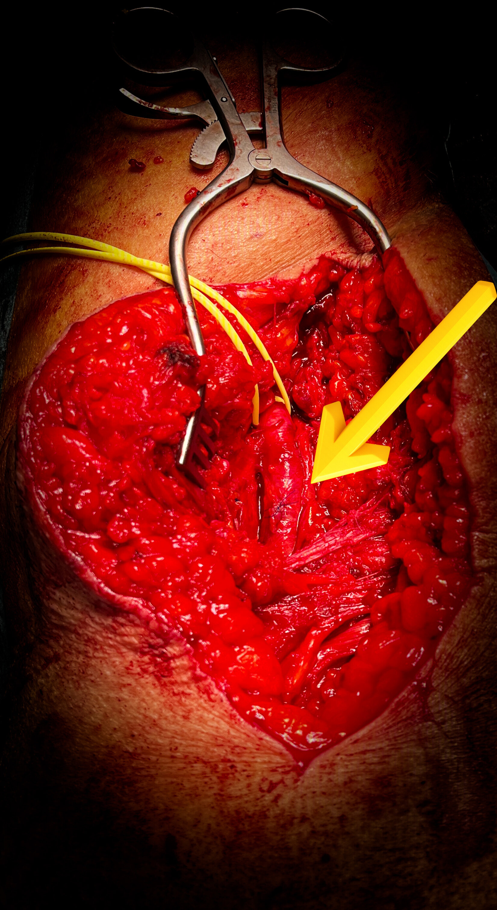 img_1367.jpeg img_1367.jpeg