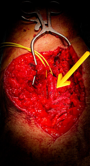 img_1367.jpeg img_1367.jpeg