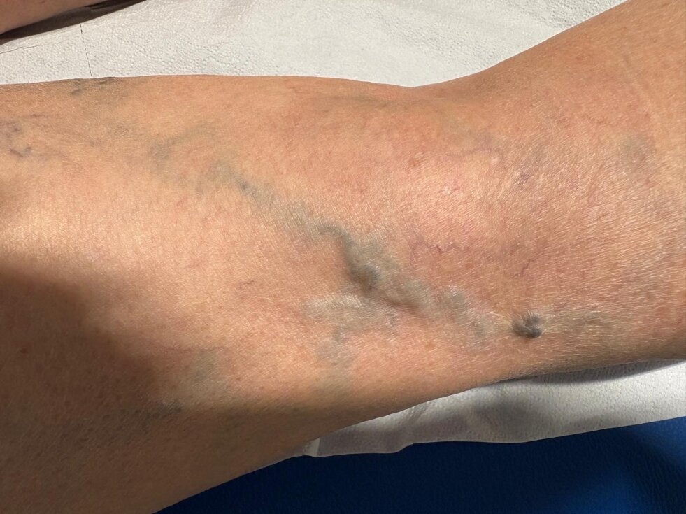 whatsapp image 2025-12-03 at 15.28.34.jpeg whatsapp image 2025-12-03 at 15.28.34.jpeg